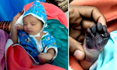 बच्ची के जन्म के बाद डॉक्टर ने लगाया इंजेक्शन, कोमल हाथ पड़ने लगा काला, हालत देख अस्पताल के उड़ गए होश