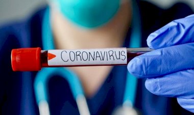 Coronavirus Update :  78.13 लाख पहुंचा कोरना वायरस का आंकड़ा, जानिए क्या है आपके राज्यों का हाल